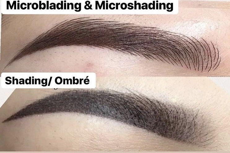 brow